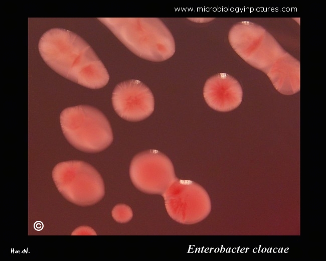 enterobacter cloacae